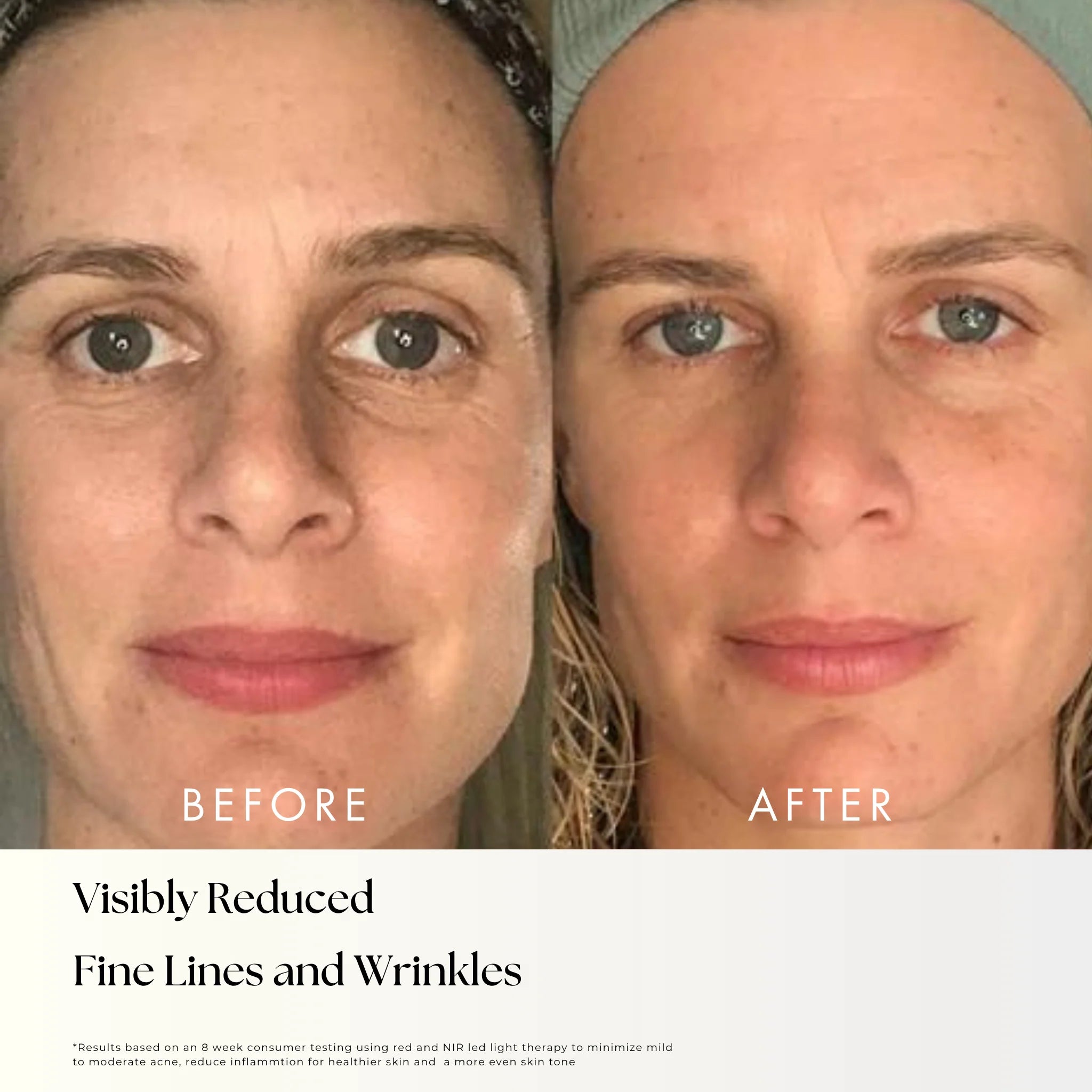 Nora - LED Light Therapy Mask