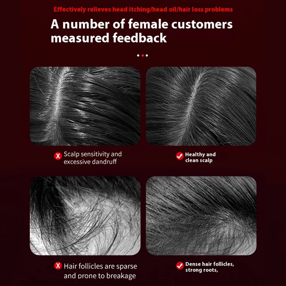 Laser Scalp Massager Comb,Red Light Therapy Hair Oil Applicator Cordless Hair Comb for Women,Abs Silicone Material