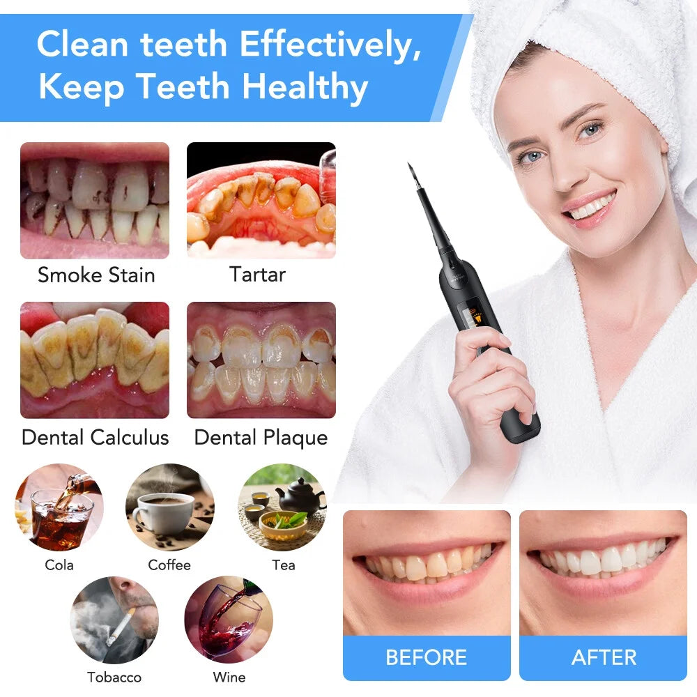Ultrasonic Tooth Cleaner Electric Plaque Remover for Teeth with LED Display and Dentist Tool Kit