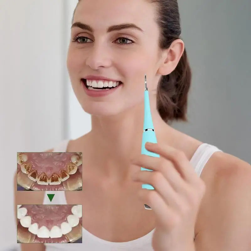 Ultrasonic Tooth Cleaner