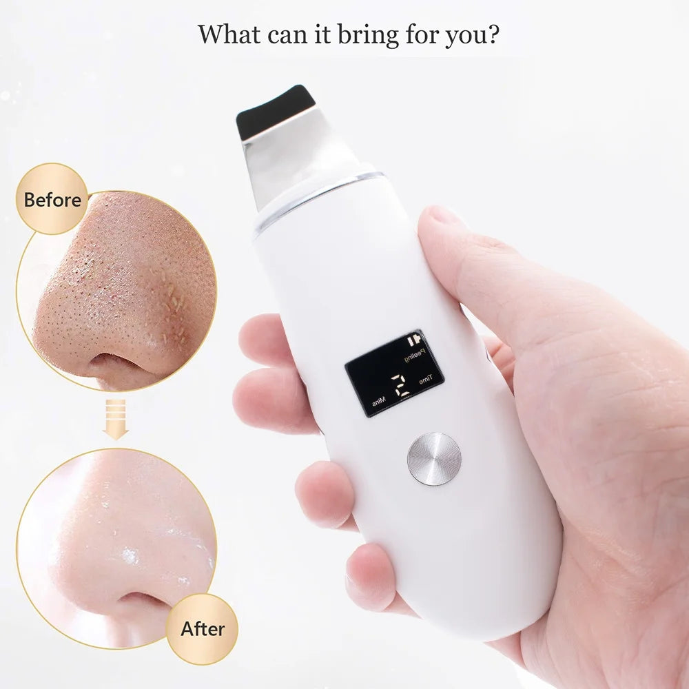 Skin Scrubber Ultrasonic Face Spatula Black Head Remover 4-In-1 for Deep Cleansing and Pore Extraction Face Tool Skin Care Women Gift