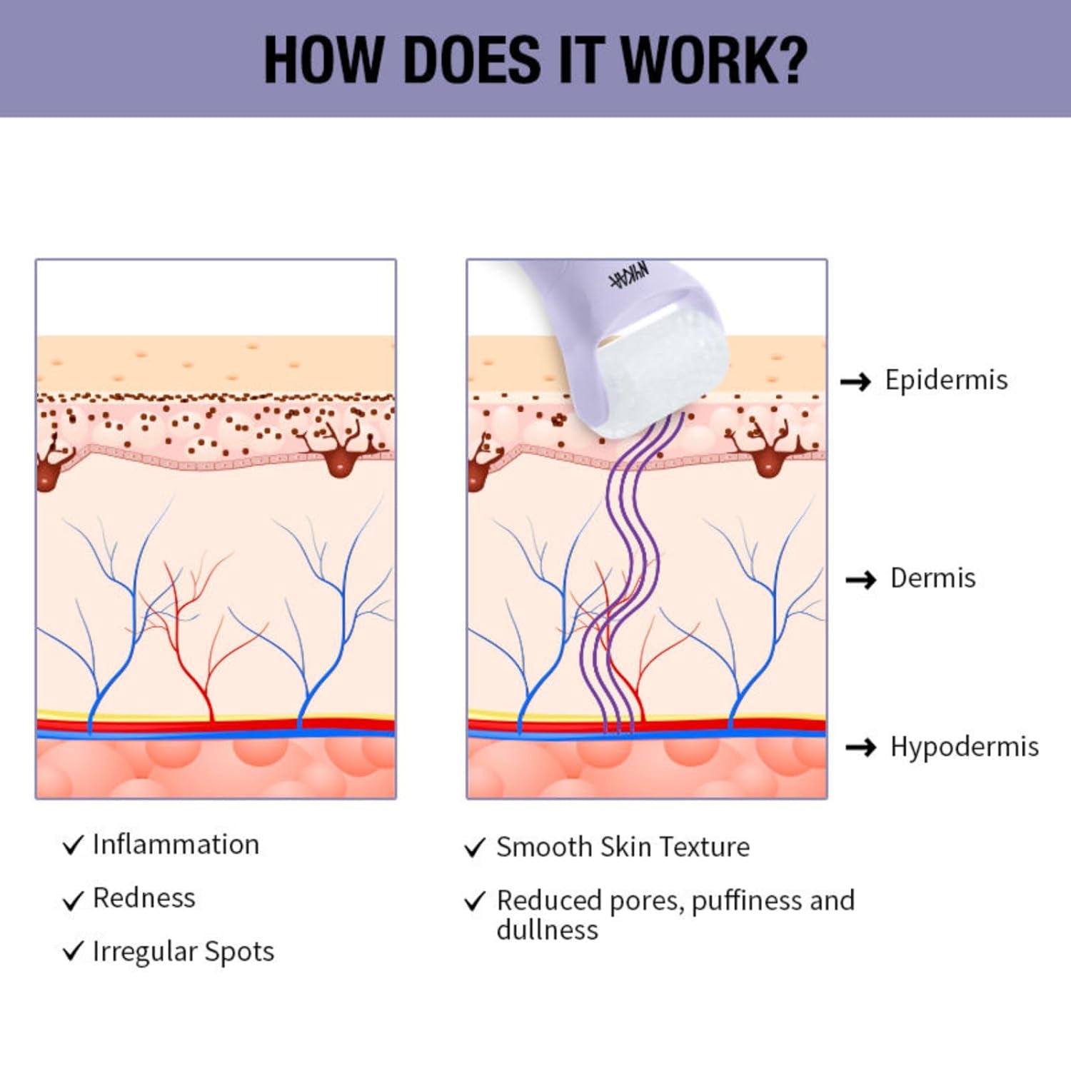 Ice Roller Massage for Face Toning - Reduces Clogged Pores - Improves Absorption - Releases Neck Stiffness - Lavender - 1 Pc